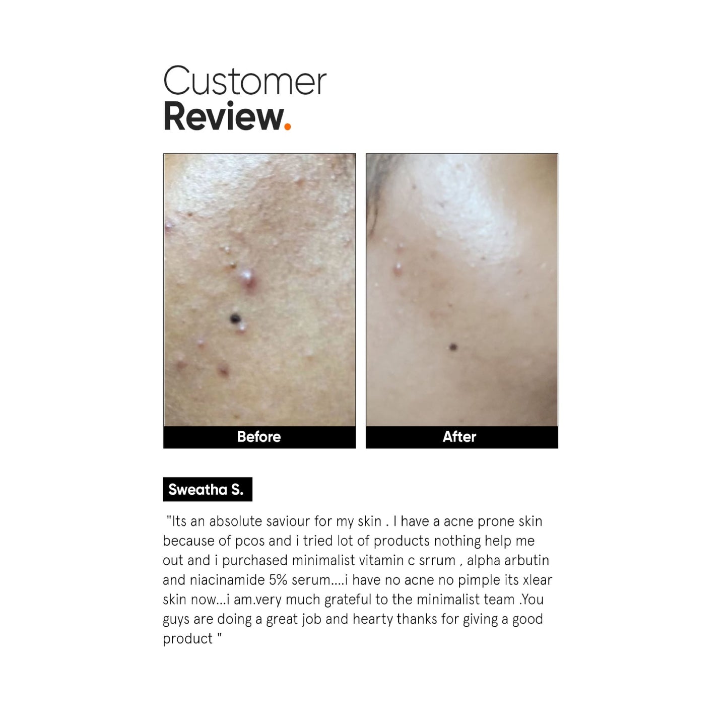 Minimalist Vitamin C 10% Face Serum