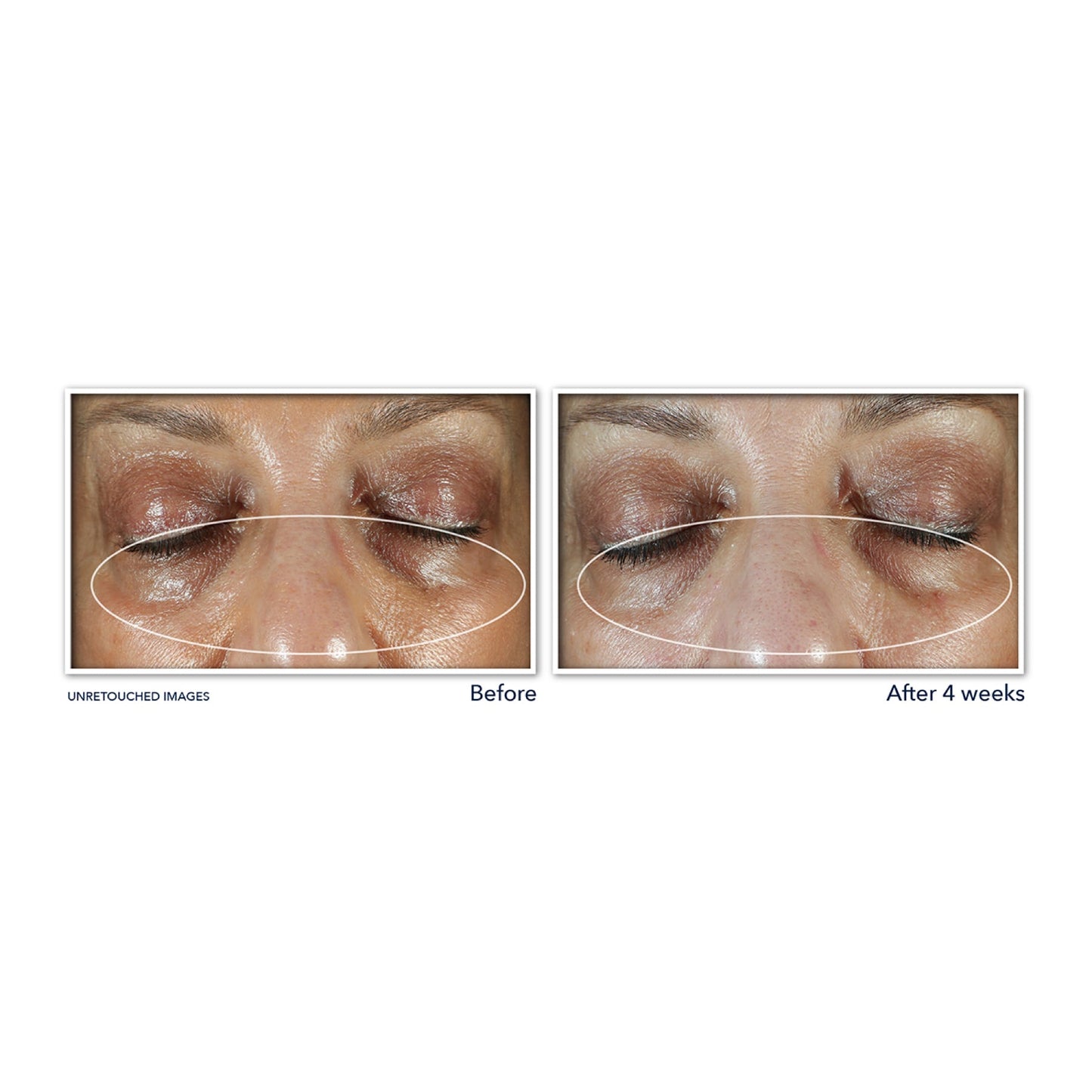 RoC Multi Correxion Even Tone + Lift Eye Cream 15ml