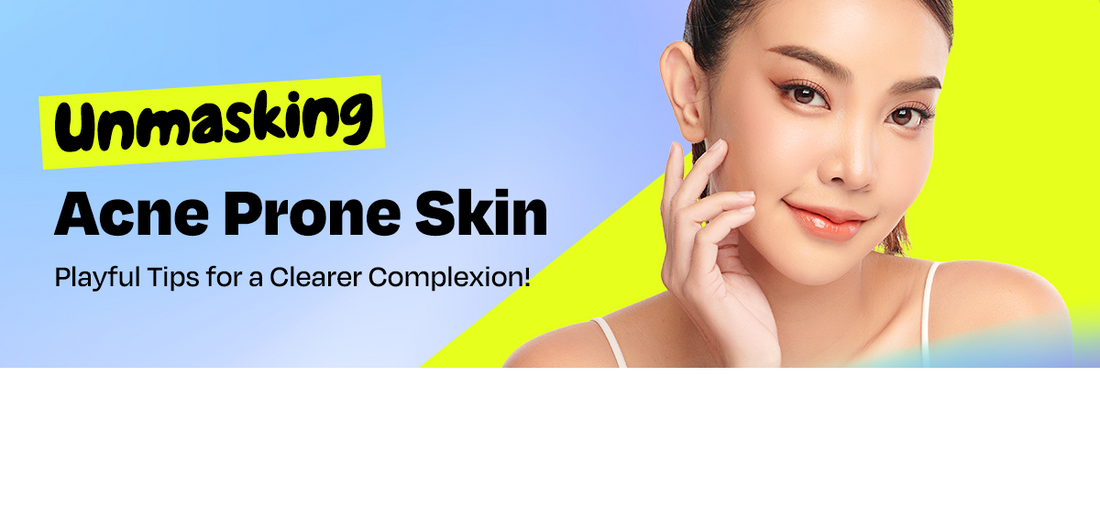 Unmasking Acne Prone Skin: Playful Tips for a Clearer Complexion!
