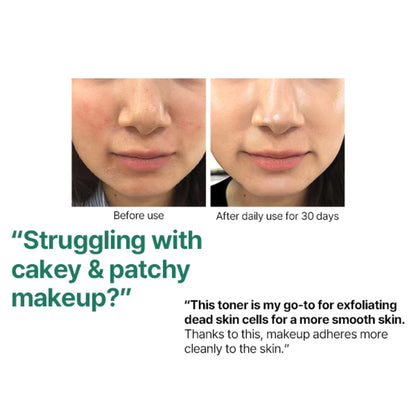 Some By Mi 30 Days Miracle Exfoliating Toner AHA-BHA-PHA 150ml