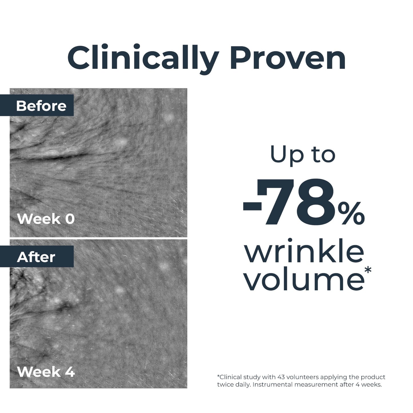 Eucerin Hyaluron-Filler Anti-Age Epicelline Serum 30ml