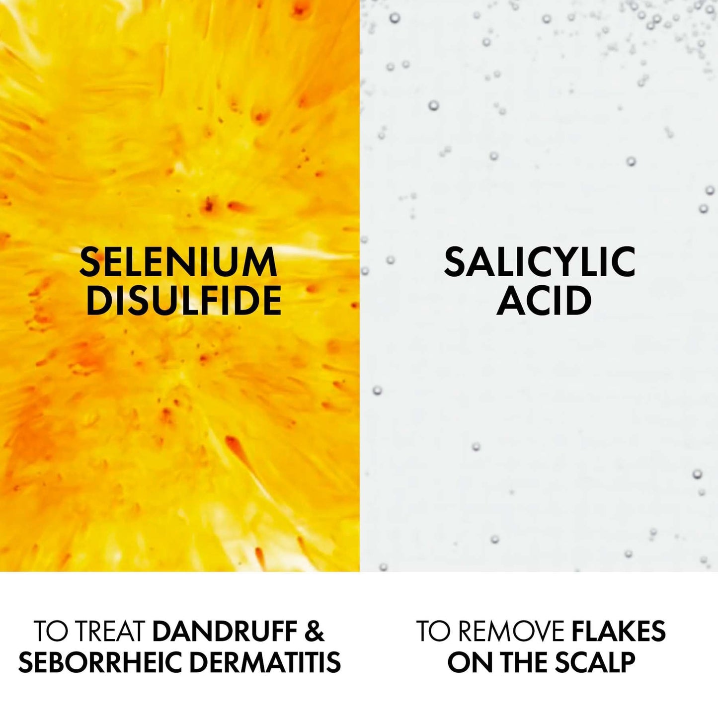 Vichy Dercos Anti-Dandruff Shampoo for Dry Hair 200ml