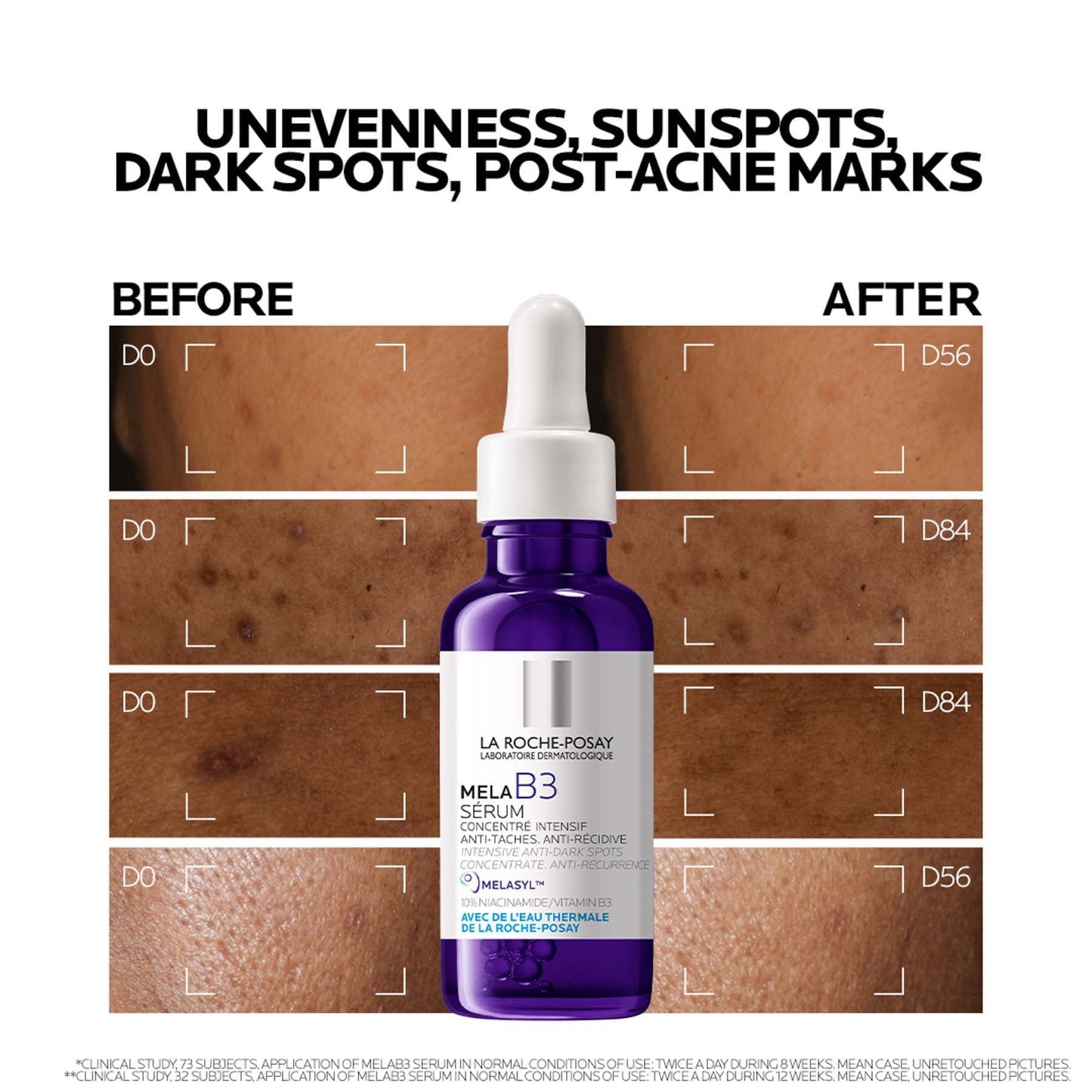 La Roche-posay Mela B3 Anti-dark Spots Concentrate Serum With Niacinamide for All Skin Types 30ml