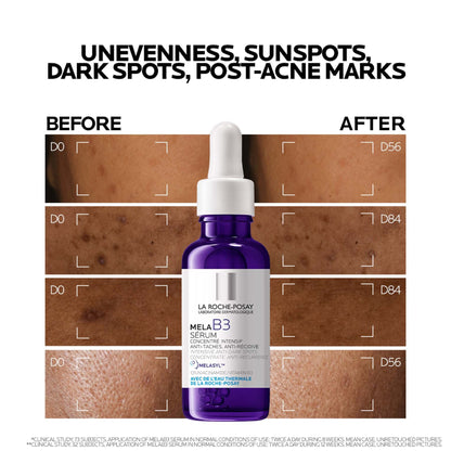 La Roche-posay Mela B3 Anti-dark Spots Concentrate Serum With Niacinamide for All Skin Types 30ml