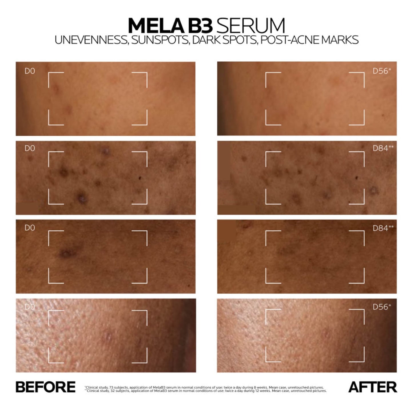 La Roche-posay Mela B3 Anti-dark Spots Concentrate Serum With Niacinamide for All Skin Types 30ml