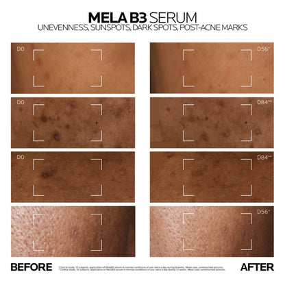 La Roche-posay Mela B3 Anti-dark Spots Concentrate Serum With Niacinamide for All Skin Types 30ml