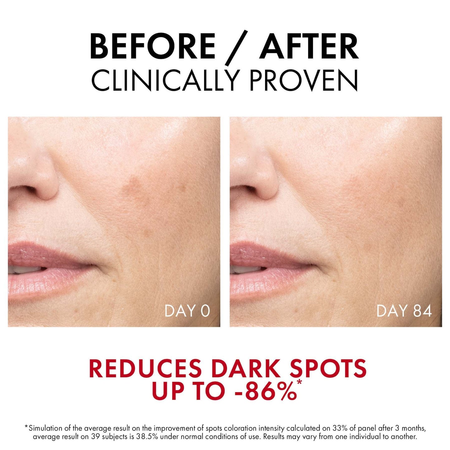 Vichy Liftactiv Specialist B3 Anti-Ageing Serum for Dark Spots & Wrinkles with Niacinamide 30ml