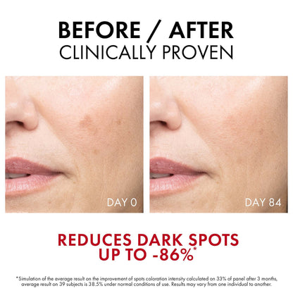 Vichy Liftactiv Specialist B3 Anti-Ageing Serum for Dark Spots & Wrinkles with Niacinamide 30ml