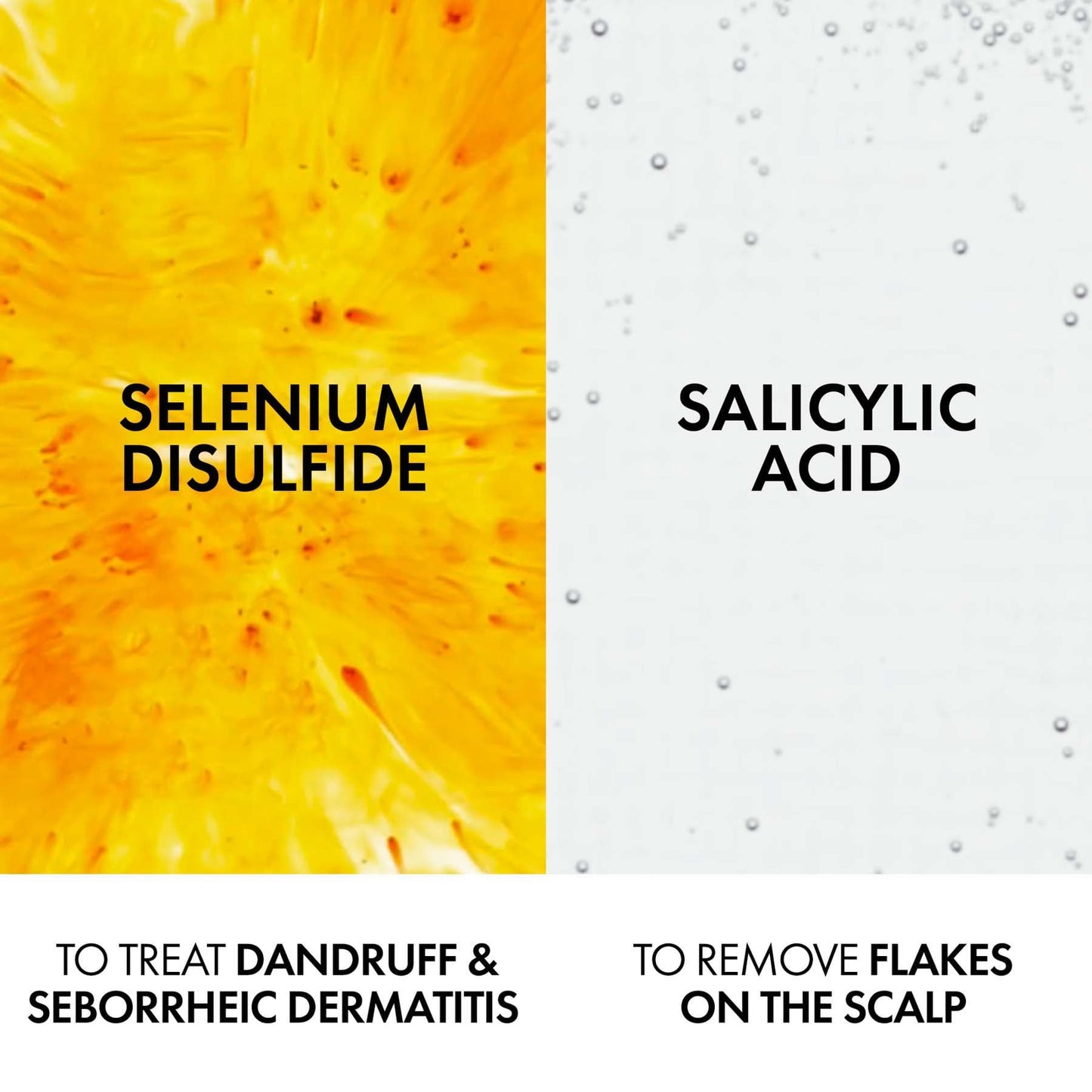 Vichy Dercos Anti-Dandruff Shampoo for Normal to Oily Hair 390ml