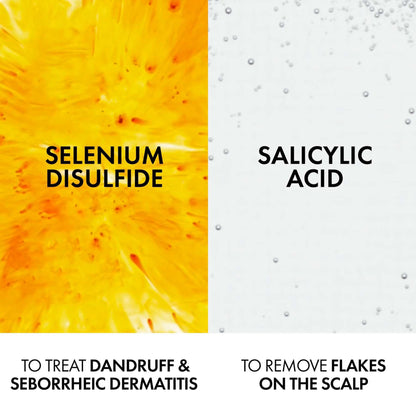 Vichy Dercos Anti-Dandruff Shampoo for Normal to Oily Hair 390ml