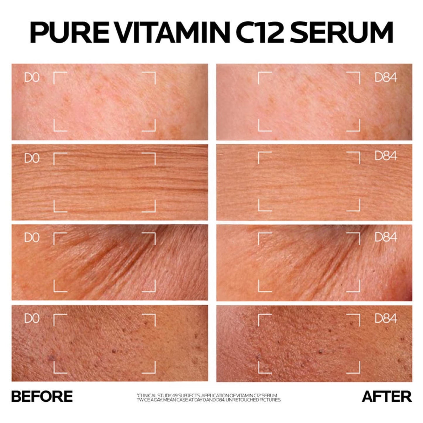 La Roche Posay 12% Pure Vitamin C Anti-aging Face Serum for All Skin Types 30ml