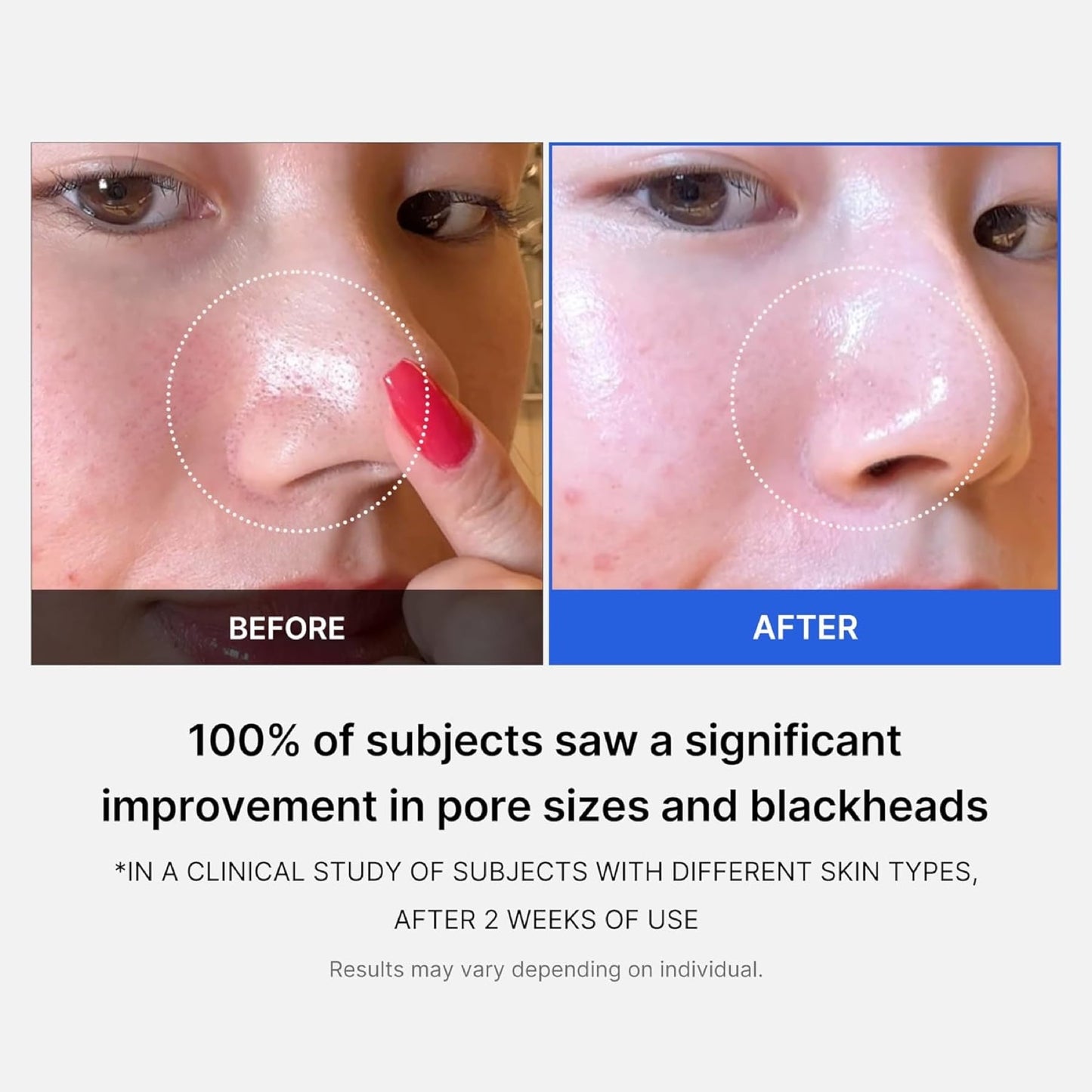 Medicube Zero Pore Pads 2.0 (70 Pads)
