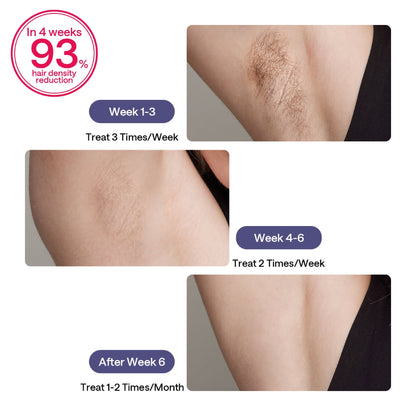 Ulike Air 3 IPL Hair Removal, Purple