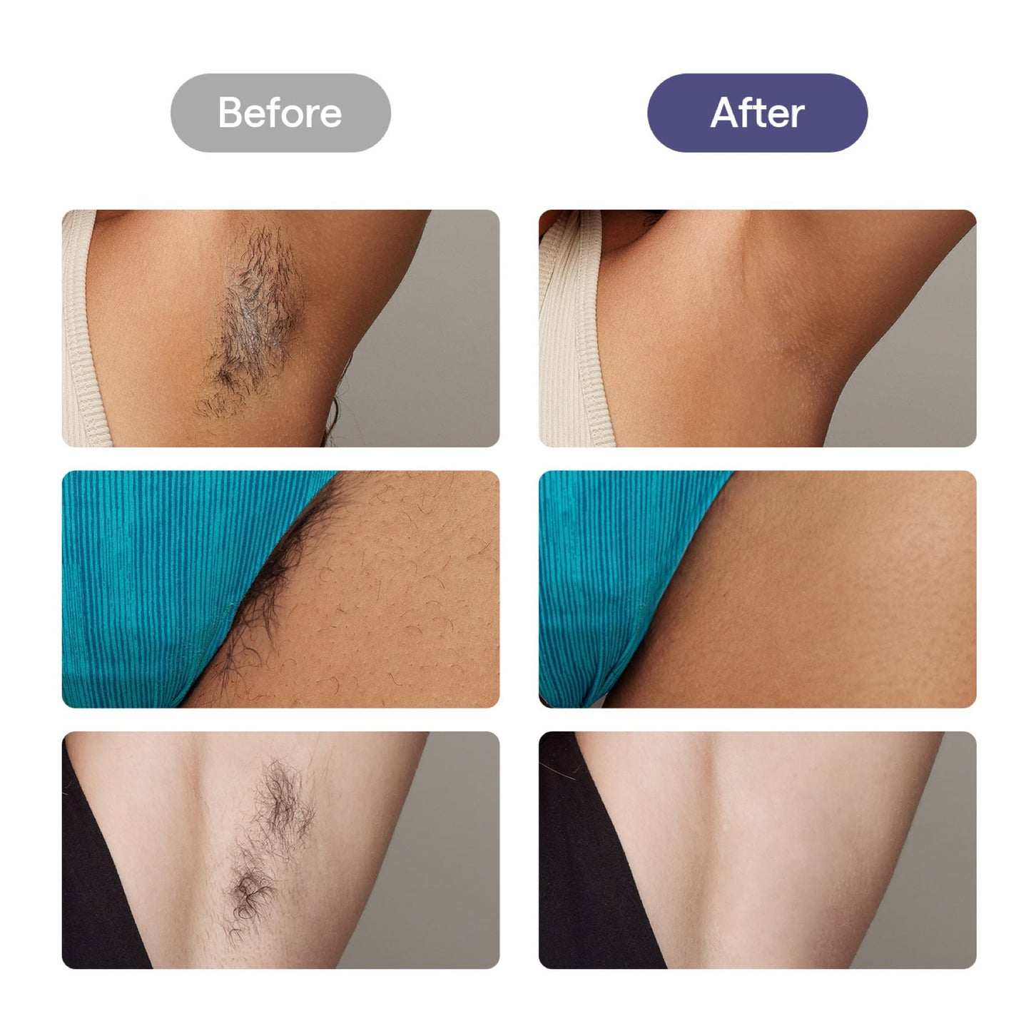 Ulike Air 3 IPL Hair Removal, Purple