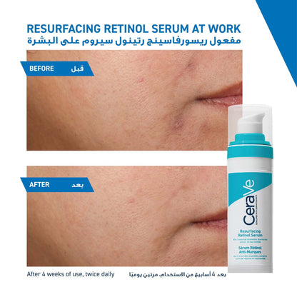 CeraVe Resurfacing Retinol Serum to Reduce the Appearance of Post-Acne Marks and Pores with Retinol, Liquorice Root Extract & Niacinamide 30ml