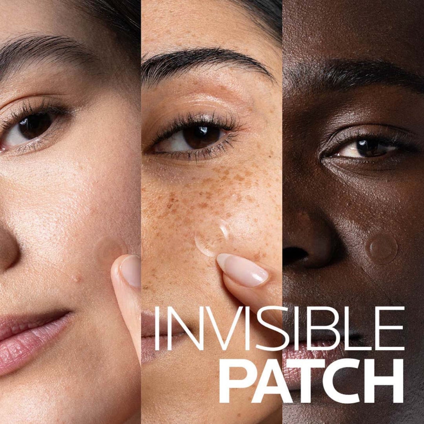 La Roche Posay Effaclar Duo+m 3h Spot Patches for Acne Prone Skin