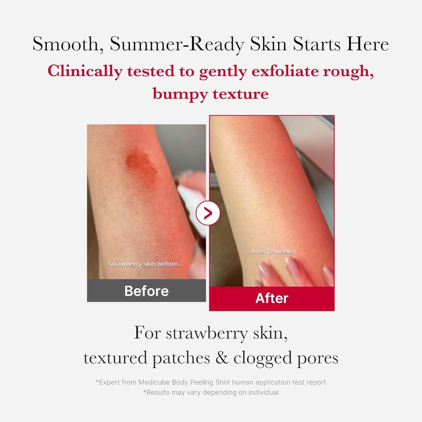 Medicube Red Acne Body Peeling Shot 2.0 110g