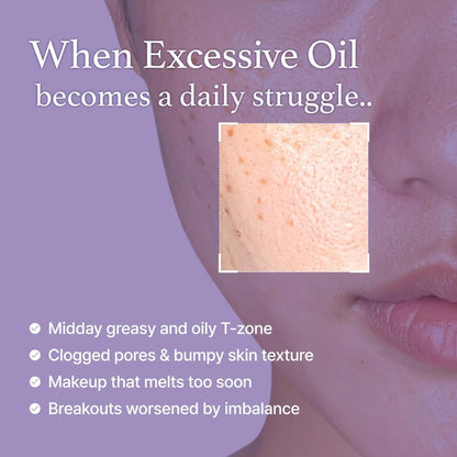 I'm From Black Rice Toner for Oily Skin