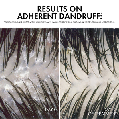 Dercos Anti-dandruff Shampoo Normal to Oily Refill 390ml