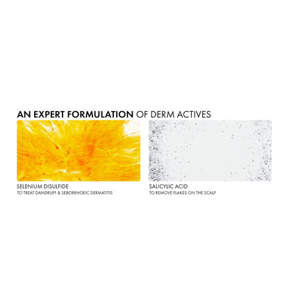 Dercos Anti-dandruff Shampoo Normal to Oily Refill 390ml