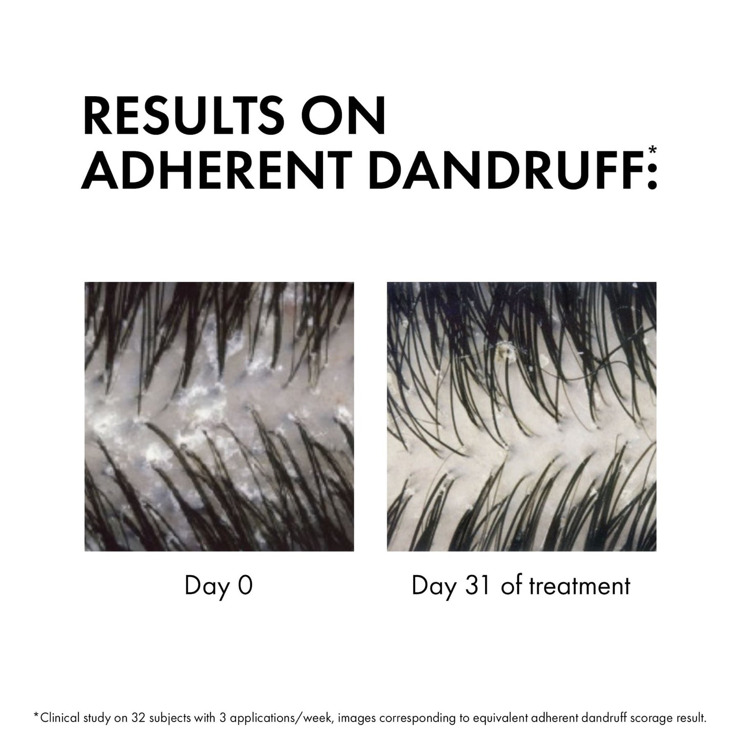 Dercos Anti-dandruff Shampoo Dry Refill 390ml