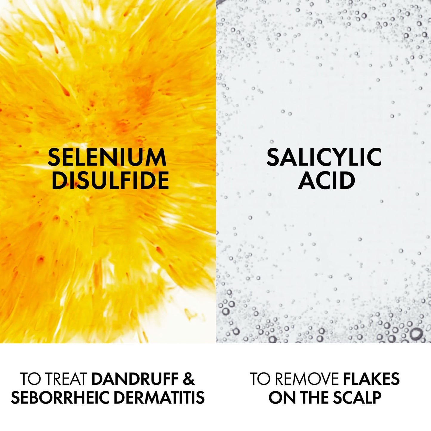 Dercos Anti-dandruff Shampoo Dry Refill 390ml