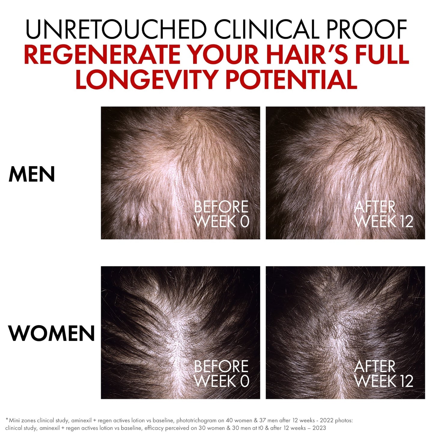 Vichy Dercos Aminexil Clinical R.e.g.e.n. Booster