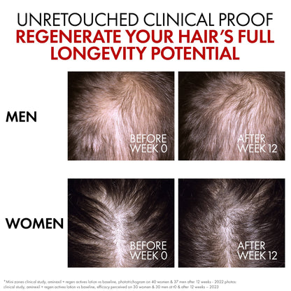 Vichy Dercos Aminexil Clinical R.e.g.e.n. Booster