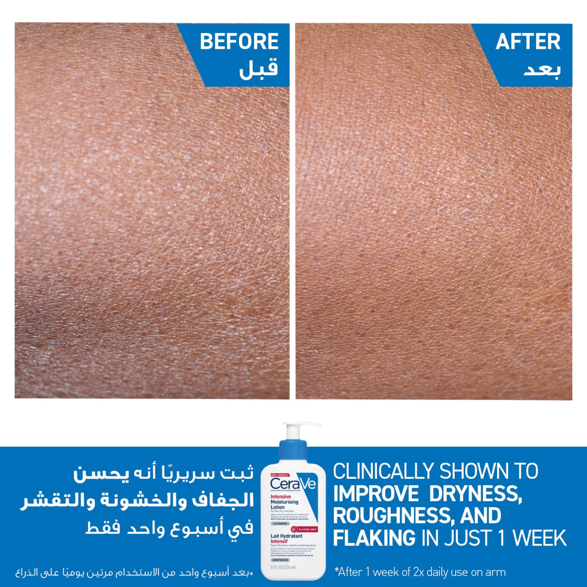 Cerave Intensive Moisturising Lotion for Very Dry, Itchy Skin 236ml