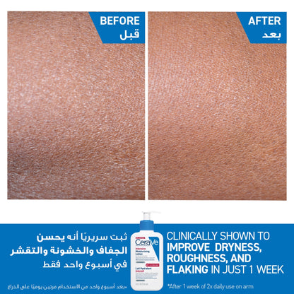 Cerave Intensive Moisturising Lotion for Very Dry, Itchy Skin 236ml