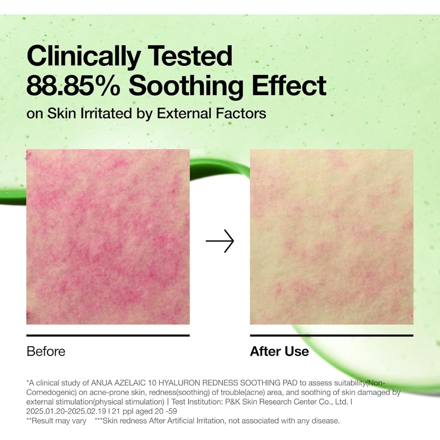 Anua Azelaic Acid 10+ Hya Soothing Pad 230ml