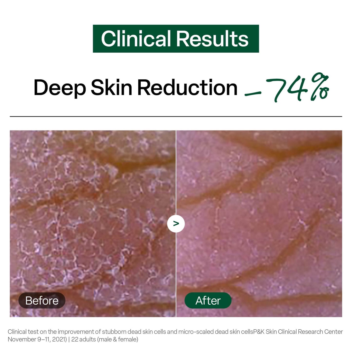 Dr.G Brightening Peeling Gel 120g