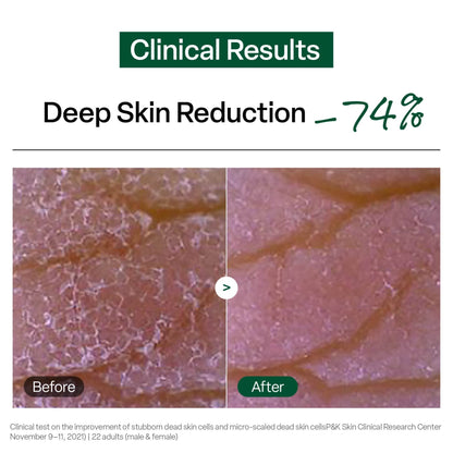 Dr.G Brightening Peeling Gel 120g
