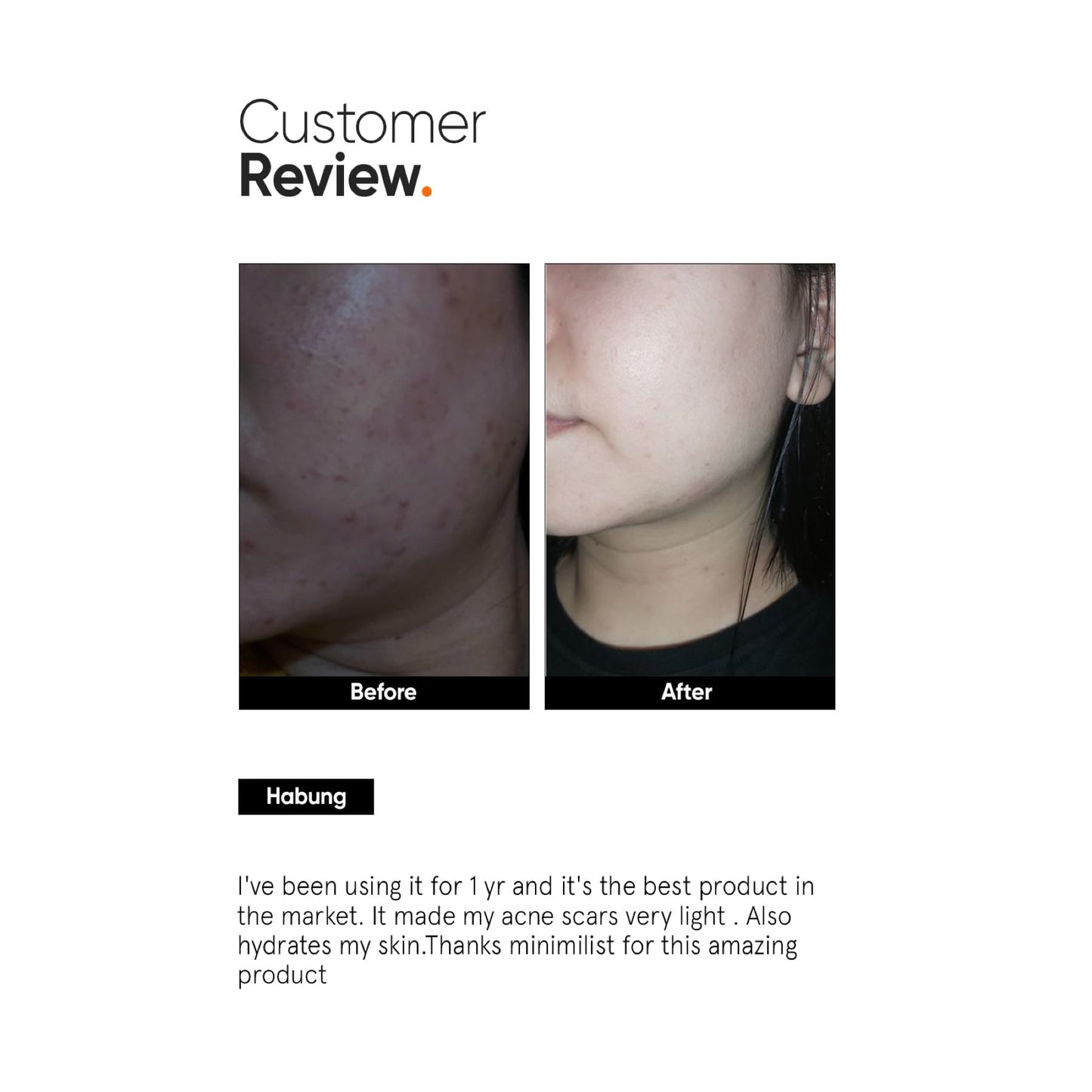 Minimalist Alpha Arbutin 02% Face Serum