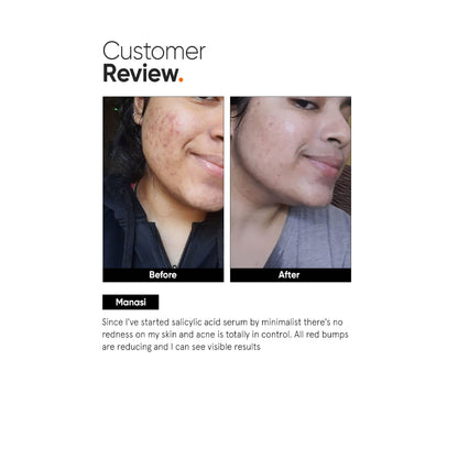Minimalist Salicylic Acid 02% Face Serum