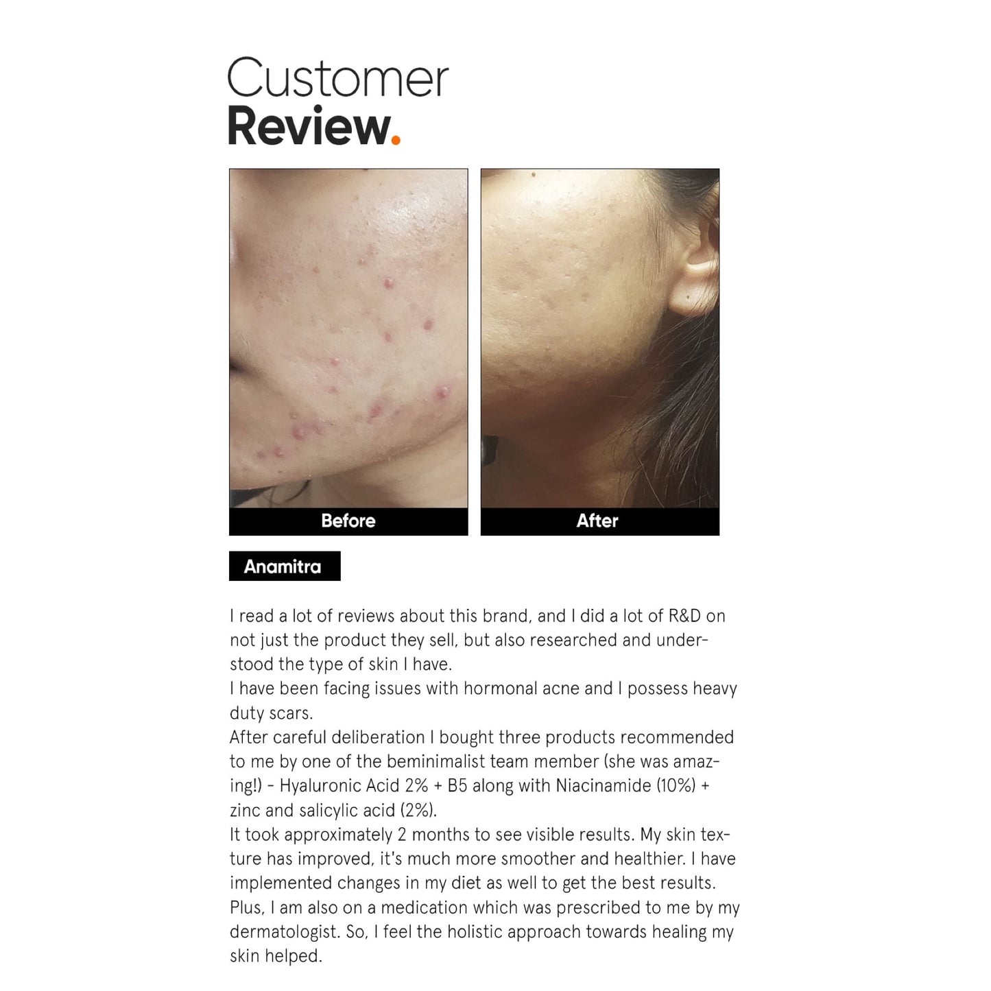 Minimalist Hyaluronic + PGA 02% Face Serum