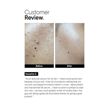 Minimalist Vitamin C 10% Face Serum