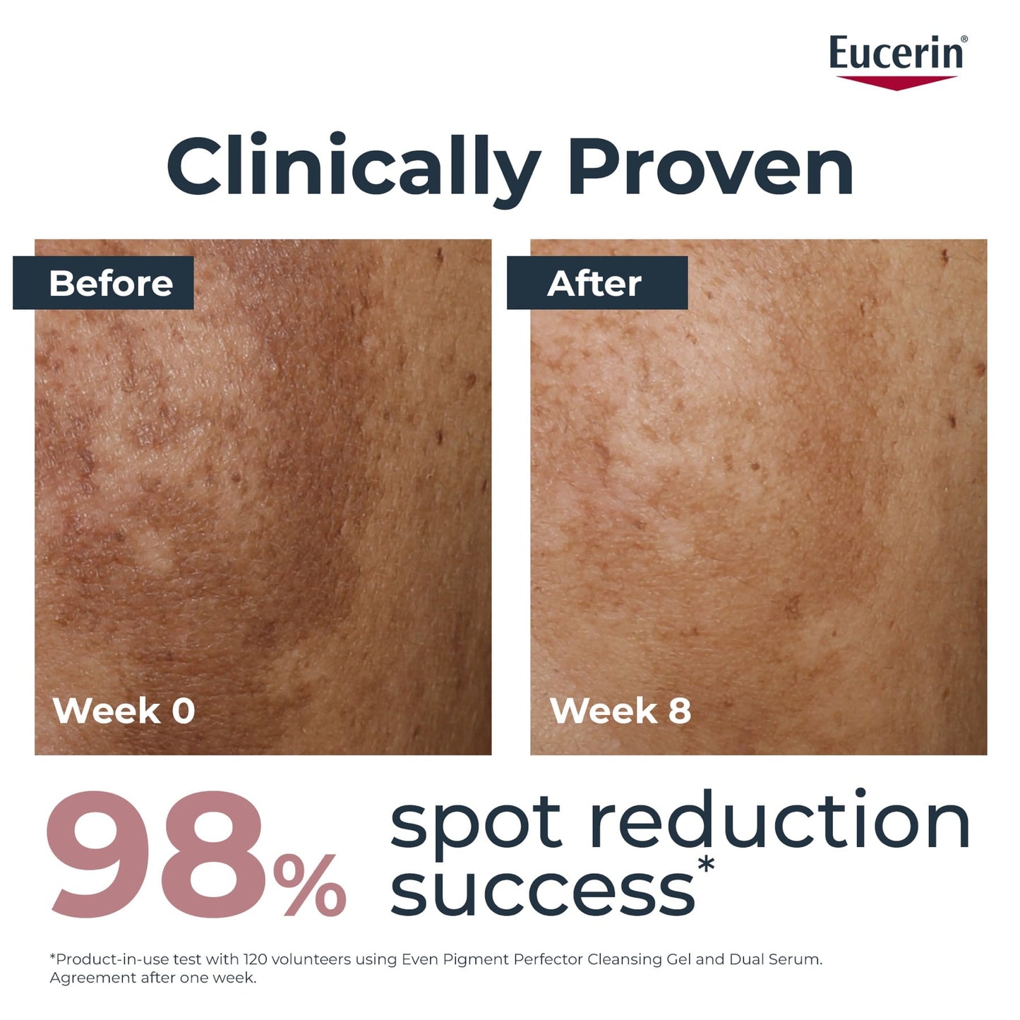 Eucerin Even Pigment Perfector Dual Face Serum 30ml
