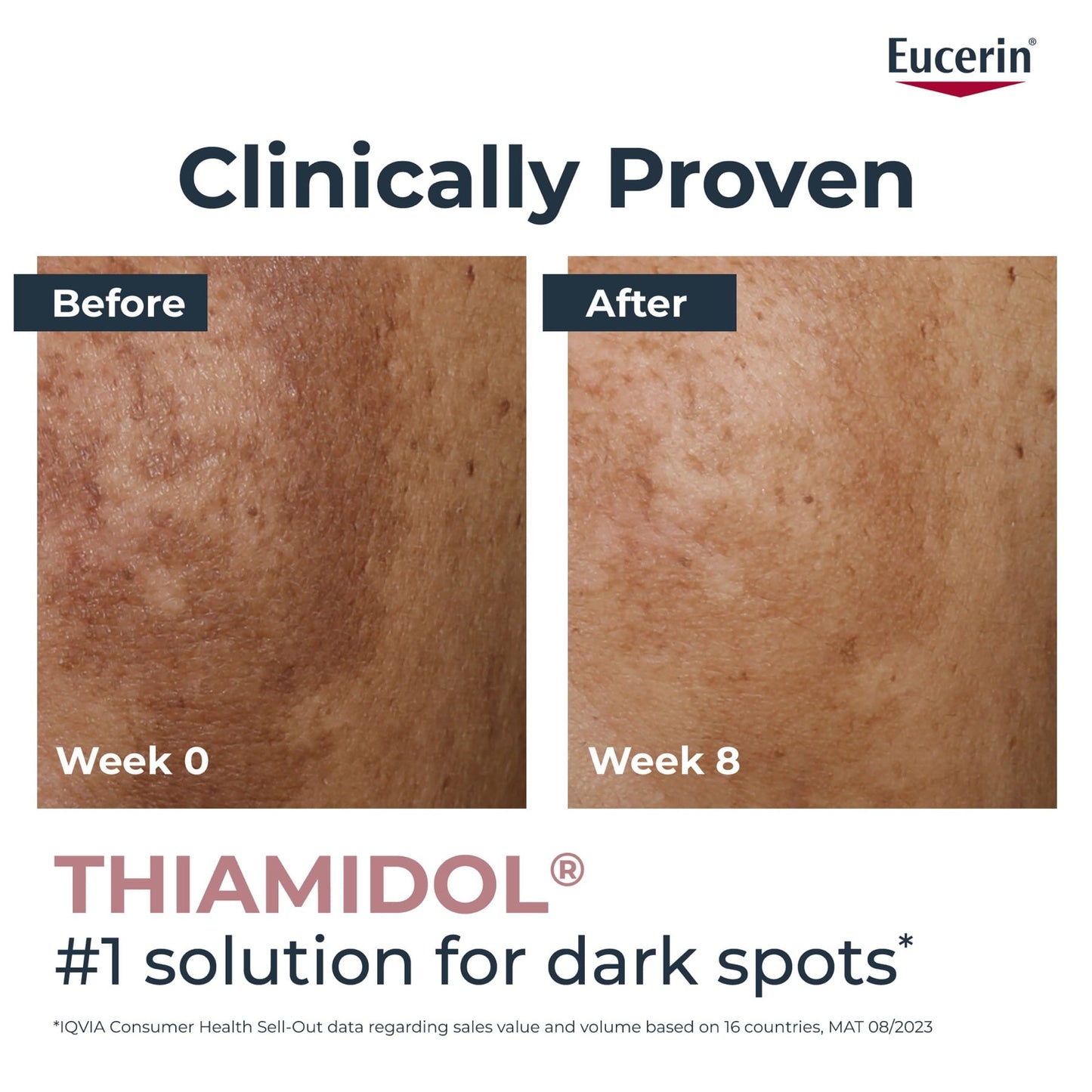 Eucerin Even Pigment Perfector Skin Perfecting Face Serum 30ml