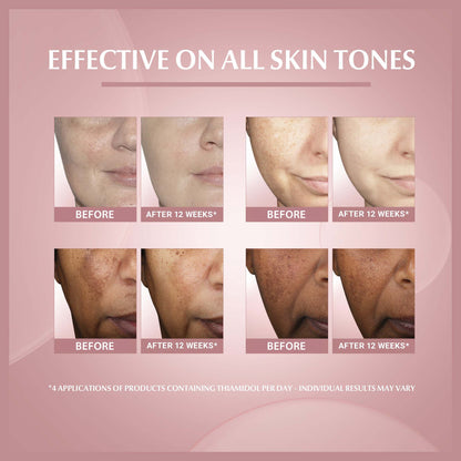 Eucerin Even Pigment Perfector Skin Perfecting Face Serum 30ml