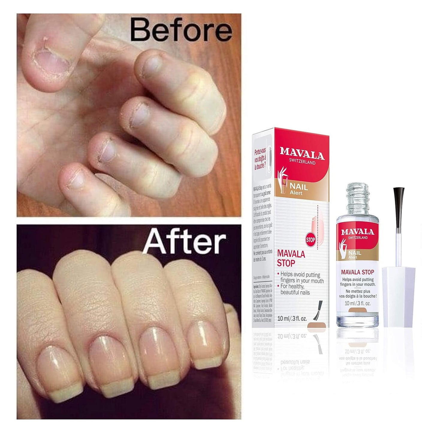 Stop Serum Clear 10ml 10ml