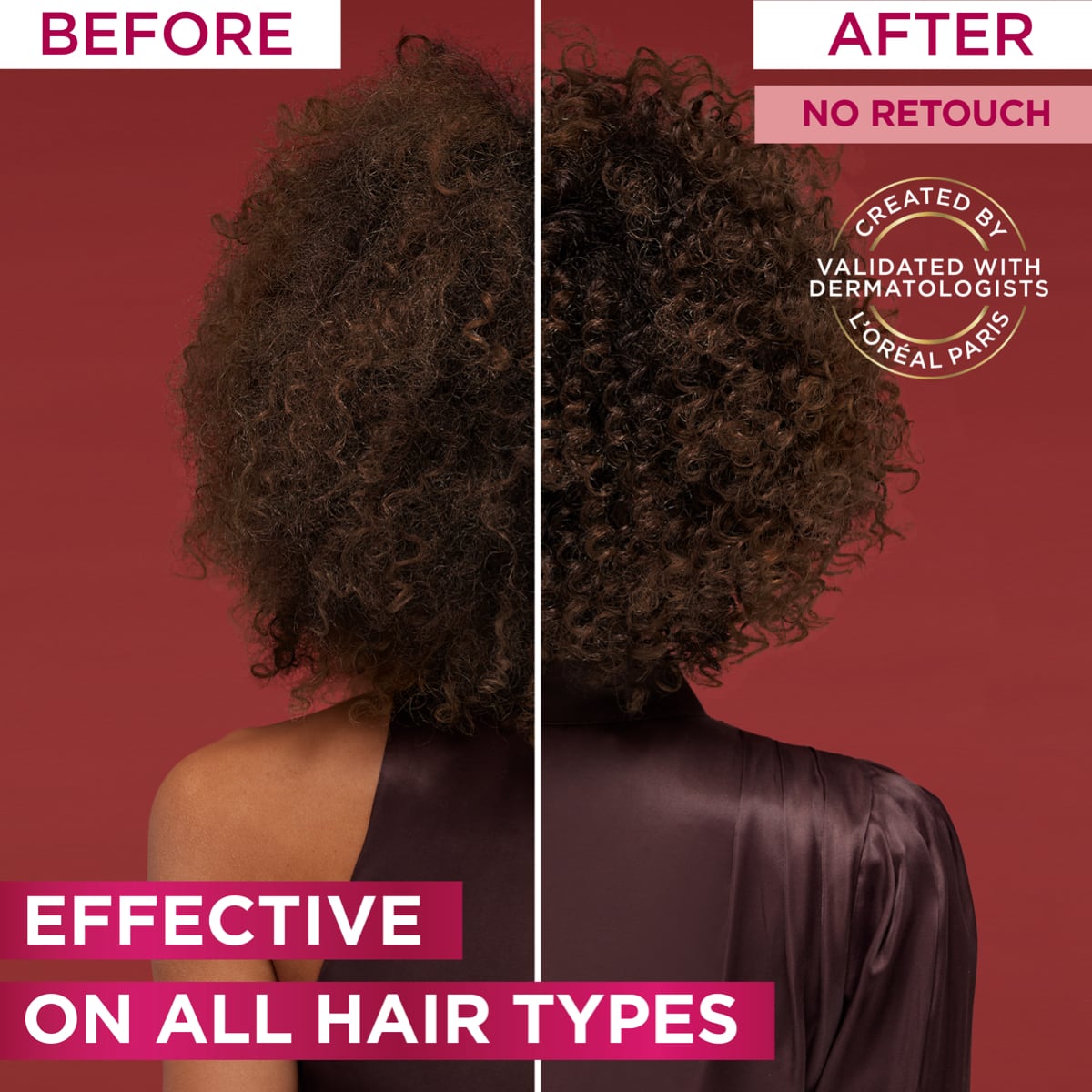 L'Oreal Paris Elvive Fall Resist Conditioner for Hair Fall 400ml 400ml