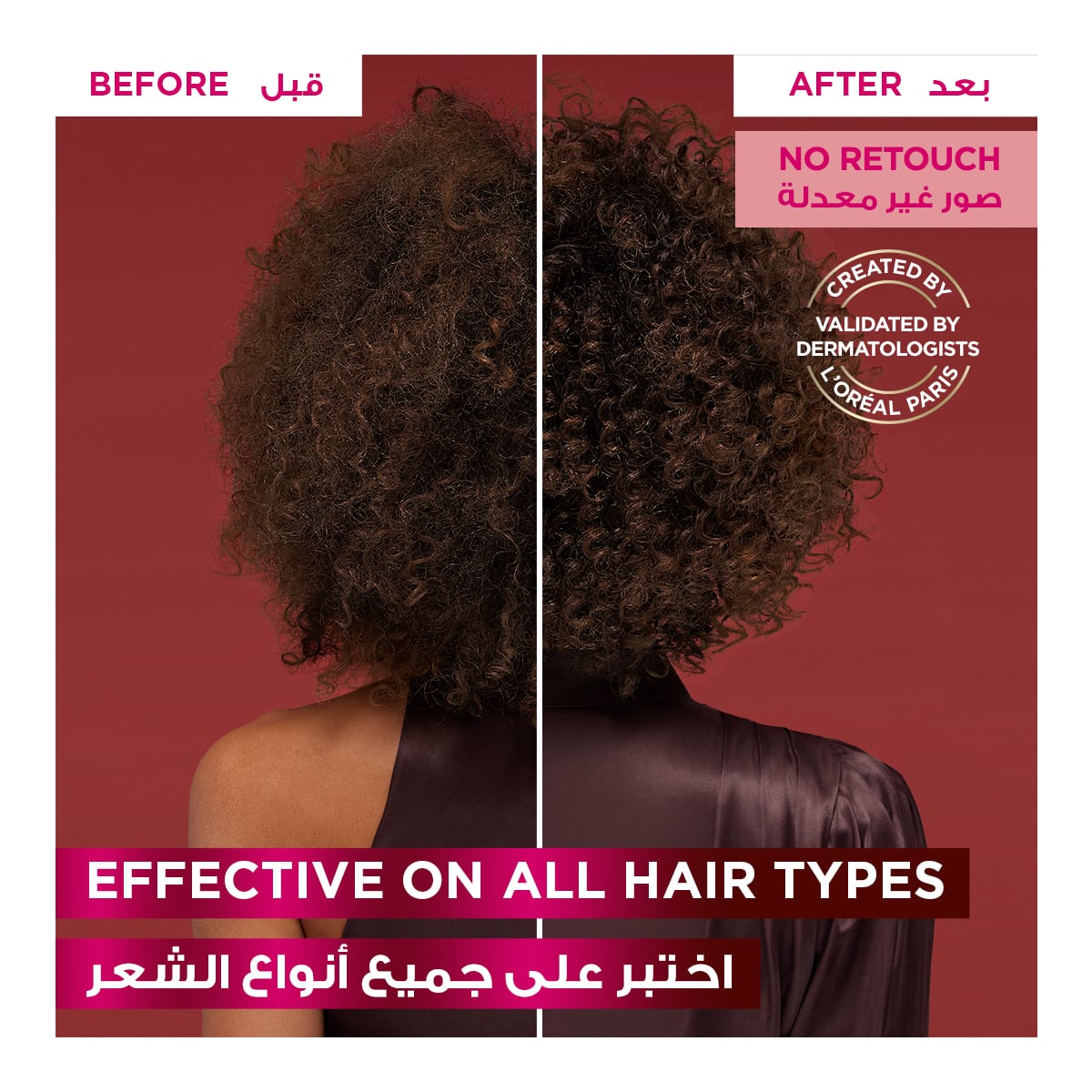 L'Oreal Paris Elvive Fall Resist Conditioner for Hair Fall 400ml 400ml