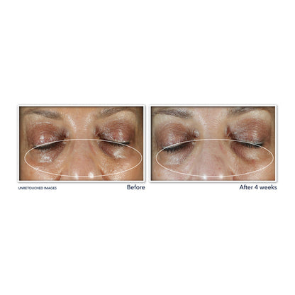 Multi Correxion Even Tone + Lift Eye Cream 15ml 15ml