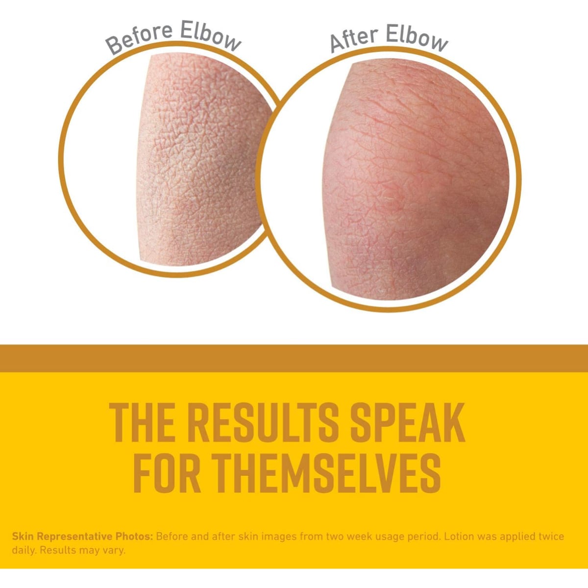 O'Keeffe's Skin Repair Body Lotion 7oz 7oz