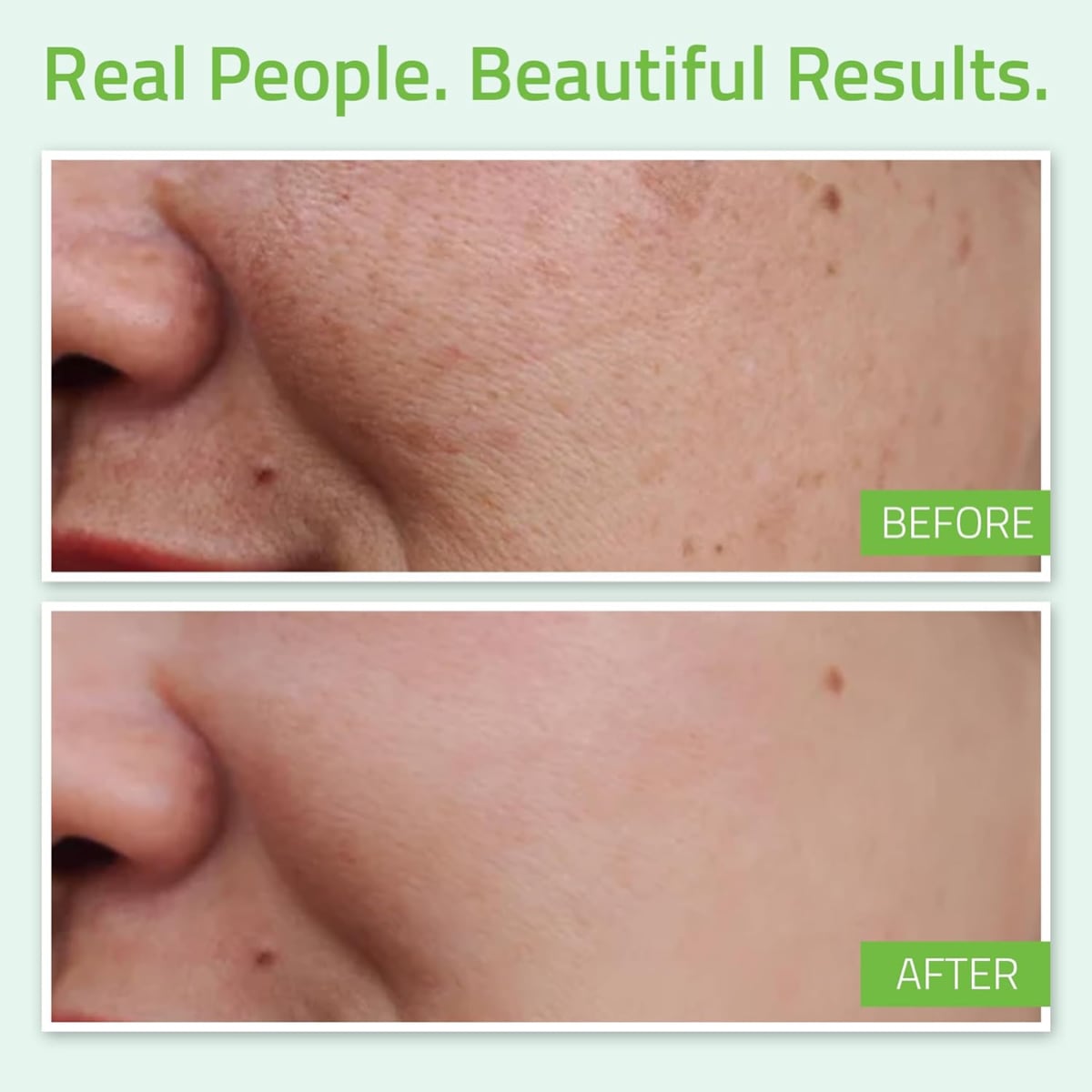 Yeouth Hyaluronic Acid Plus Serum with Vitamin C 1oz