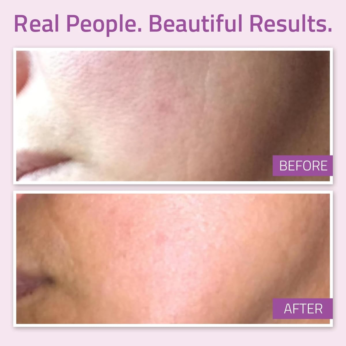 Yeouth Anti-Aging Super Serum 1oz 1oz