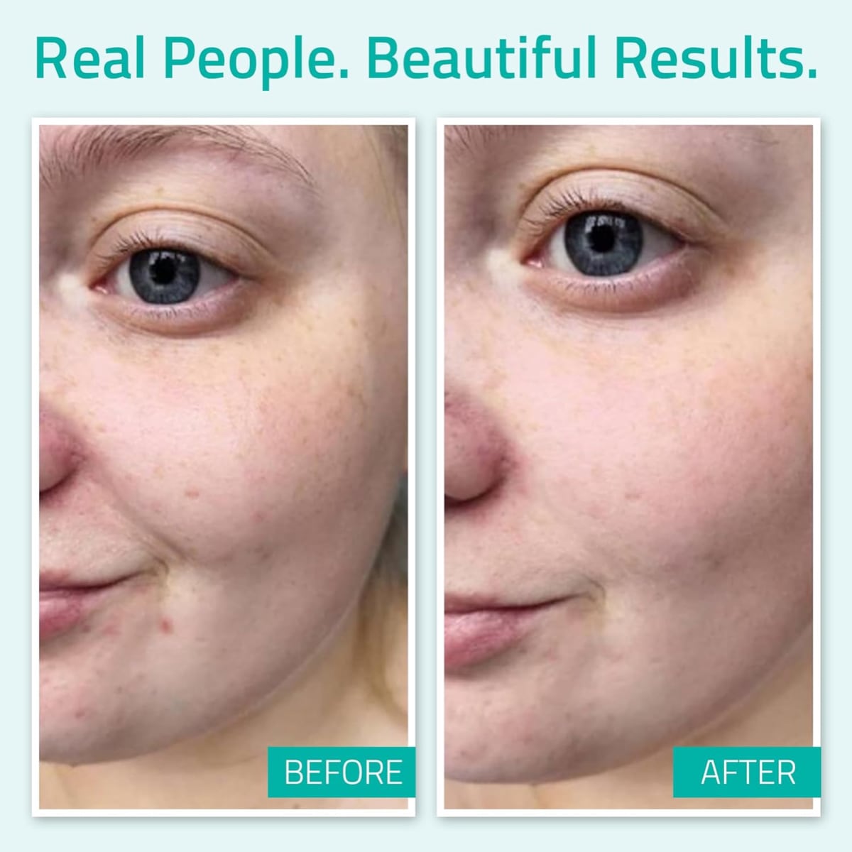 Yeouth Pure Hyaluronic Acid Serum 1oz