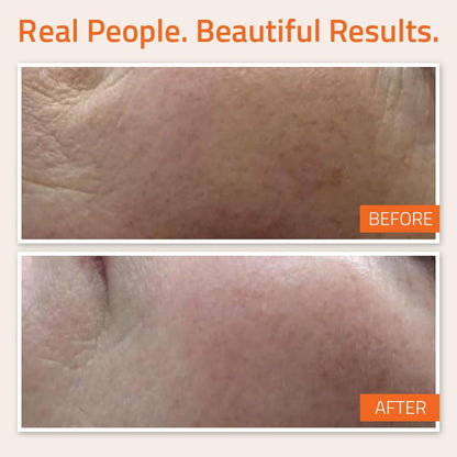 Yeouth Vitamin C and E Serum 1oz