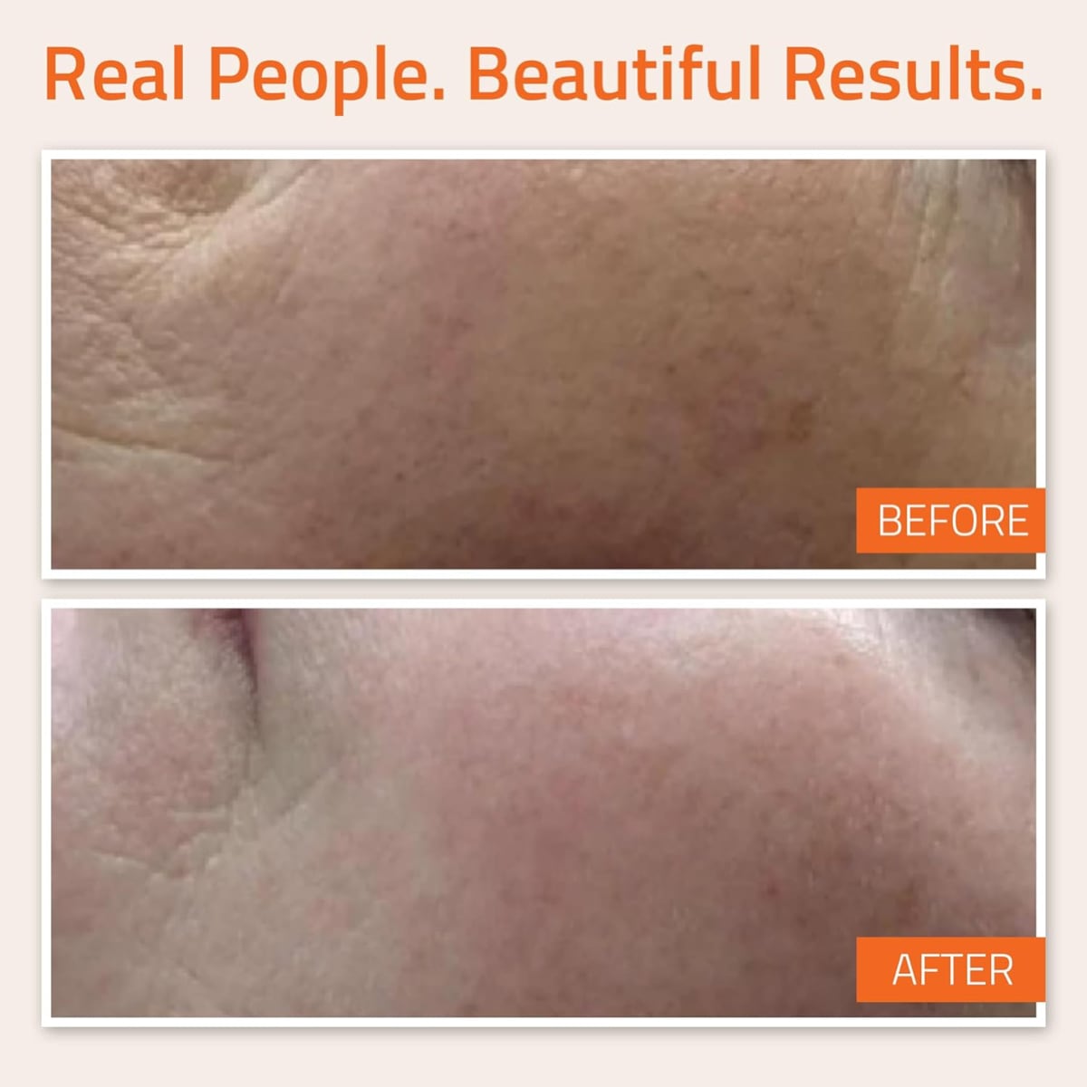 Yeouth Vitamin C and E Serum 2oz